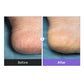 baren - Shea Butter Sleeping Heel Patch